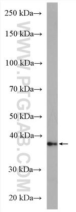 CERK Antibody in Western Blot (WB)