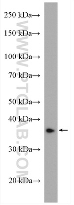CERK Antibody in Western Blot (WB)