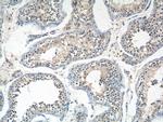 ANKRD13B Antibody in Immunohistochemistry (Paraffin) (IHC (P))
