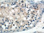 ANKRD13B Antibody in Immunohistochemistry (Paraffin) (IHC (P))