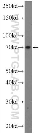 ANKRD13B Antibody in Western Blot (WB)