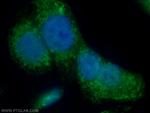 IQCK Antibody in Immunocytochemistry (ICC/IF)