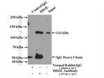 DIS3L Antibody in Immunoprecipitation (IP)