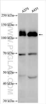 EPHA2 Antibody in Western Blot (WB)