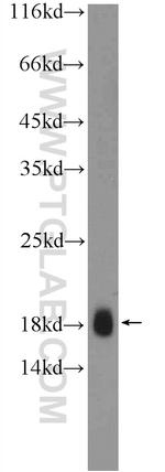 TR2IT1 Antibody in Western Blot (WB)