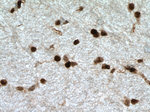 OLIG2 Antibody in Immunohistochemistry (Paraffin) (IHC (P))