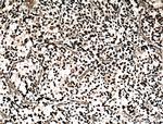 OLIG2 Antibody in Immunohistochemistry (Paraffin) (IHC (P))