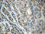 C11orf74 Antibody in Immunohistochemistry (Paraffin) (IHC (P))