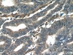 ORAI3 Antibody in Immunohistochemistry (Paraffin) (IHC (P))