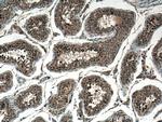 CCDC88C Antibody in Immunohistochemistry (Paraffin) (IHC (P))