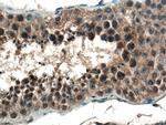 CCDC88C Antibody in Immunohistochemistry (Paraffin) (IHC (P))
