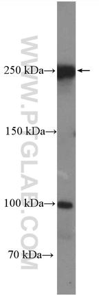 CCDC88C Antibody in Western Blot (WB)