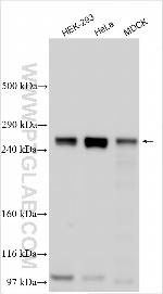 MTCL1 Antibody in Western Blot (WB)