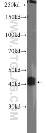 LRP2BP Antibody in Western Blot (WB)