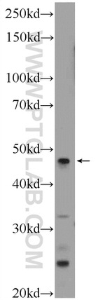 LRP2BP Antibody in Western Blot (WB)