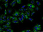 RMND5B Antibody in Immunocytochemistry (ICC/IF)