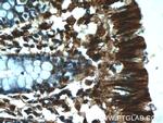 RMND5B Antibody in Immunohistochemistry (Paraffin) (IHC (P))