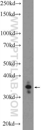 PHOX2A Antibody in Western Blot (WB)