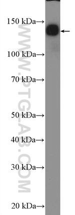 NF-M Antibody in Western Blot (WB)