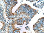 SMCO4 Antibody in Immunohistochemistry (Paraffin) (IHC (P))