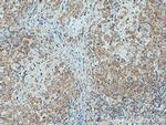 c-Cbl Antibody in Immunohistochemistry (Paraffin) (IHC (P))