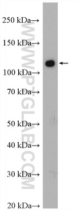 c-Cbl Antibody in Western Blot (WB)