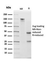 Kallikrein 5 (KLK5) Antibody in SDS-PAGE (SDS-PAGE)