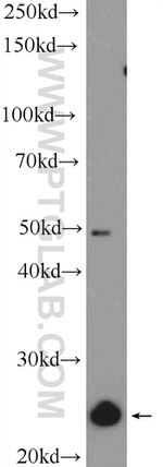 ZMAT2 Antibody in Western Blot (WB)