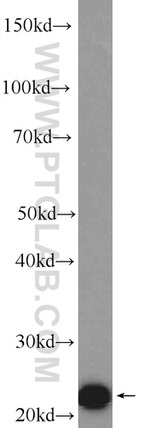 ZMAT2 Antibody in Western Blot (WB)