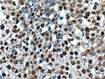 VSX2 Antibody in Immunohistochemistry (Paraffin) (IHC (P))