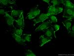 TFAP2E Antibody in Immunocytochemistry (ICC/IF)