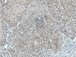 TFAP2E Antibody in Immunohistochemistry (Paraffin) (IHC (P))