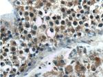 TPRX1 Antibody in Immunohistochemistry (Paraffin) (IHC (P))