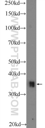 TPRX1 Antibody in Western Blot (WB)