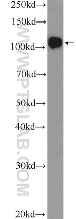 DGCR8 N-terminal Antibody in Western Blot (WB)