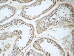 RGSL1 Antibody in Immunohistochemistry (Paraffin) (IHC (P))