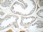RGSL1 Antibody in Immunohistochemistry (Paraffin) (IHC (P))