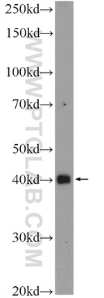 SMAD7 Antibody in Western Blot (WB)