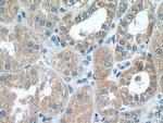 RAB11FIP3 Antibody in Immunohistochemistry (Paraffin) (IHC (P))