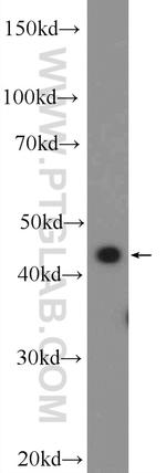 SUDS3 Antibody in Western Blot (WB)