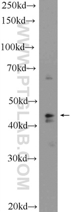 SUDS3 Antibody in Western Blot (WB)