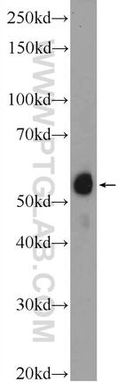 ACD Antibody in Western Blot (WB)