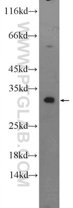 DECR2 Antibody in Western Blot (WB)