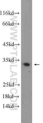 DECR2 Antibody in Western Blot (WB)