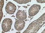 TUBGCP2 Antibody in Immunohistochemistry (Paraffin) (IHC (P))