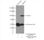 TUBGCP2 Antibody in Immunoprecipitation (IP)
