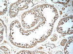 TEX264 Antibody in Immunohistochemistry (Paraffin) (IHC (P))