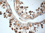 TEX264 Antibody in Immunohistochemistry (Paraffin) (IHC (P))