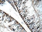 TEX264 Antibody in Immunohistochemistry (Paraffin) (IHC (P))