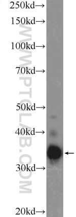 TEX264 Antibody in Western Blot (WB)